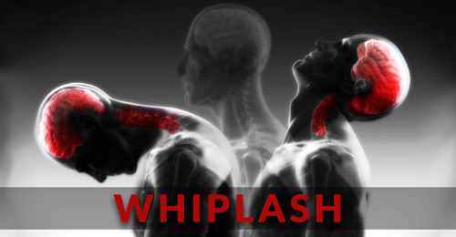 Whiplash Sacramento Keppler Chiropractic