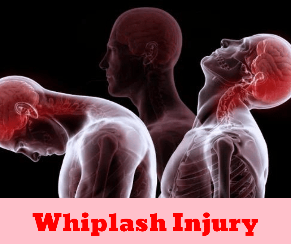 Whiplash Injury